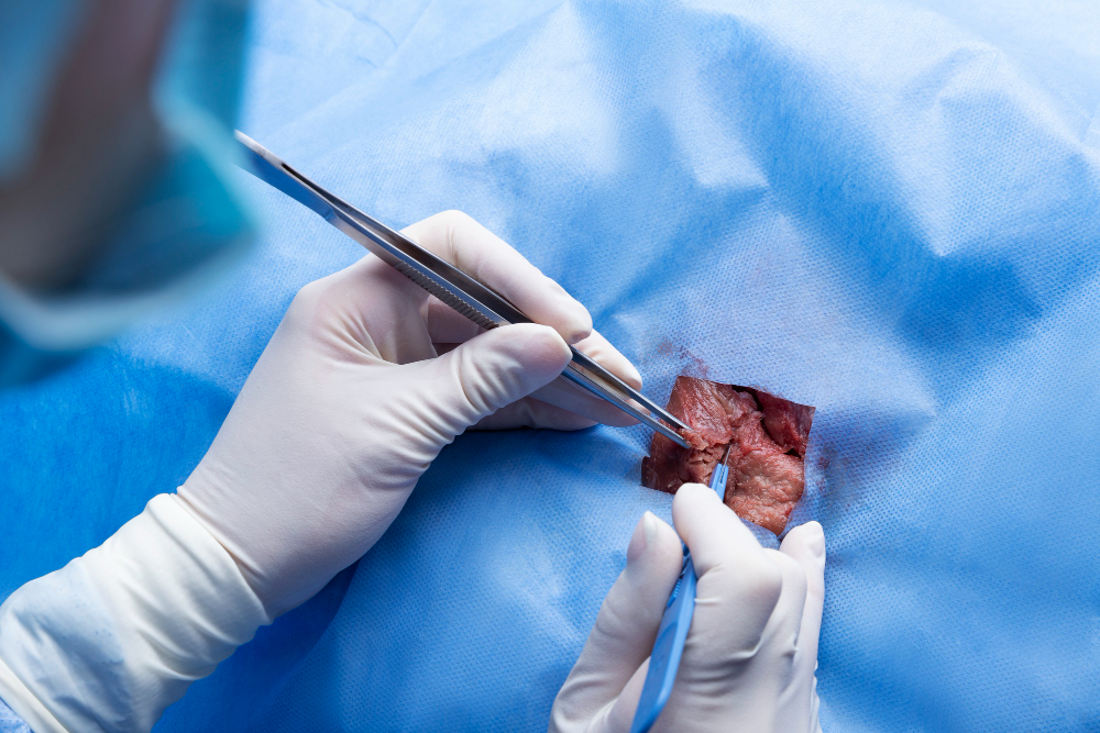 Gastrointestinal Surgery
